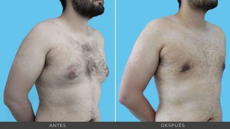 ¿Por qué es importante consultar a un médico?
