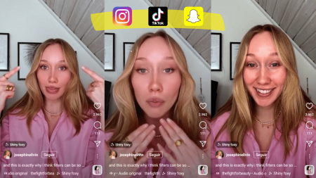 ¿Cuáles son los motivos detrás de la dismorfia corporal en la juventud?